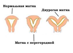 ماذا تعني bicornylum؟