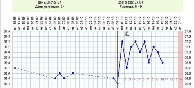 在计划怀孕时取消杜拉斯顿