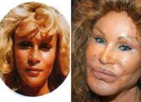 Jocelyn Wildenstein - oběť plastické chirurgie