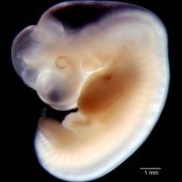 Embryo 6 týdnů