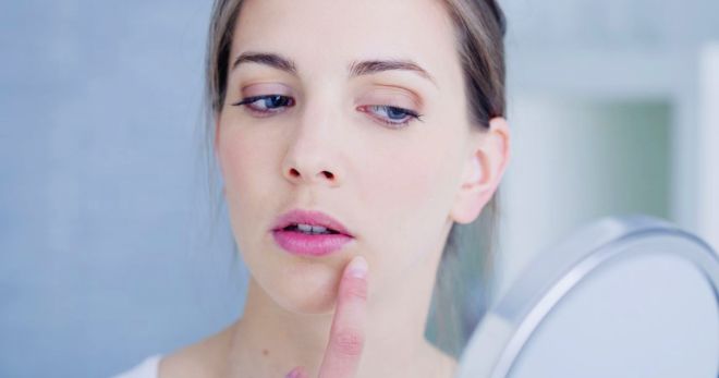 Херпес на лицето - видове обриви и най-ефективните начини на лечение