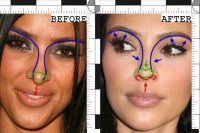tvář Kim Kardashian před a po plastech