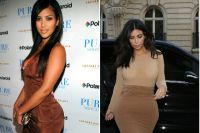 Hýždí Kim Kardashian po plastech