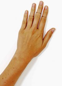пръстени на фаланги на пръсти3