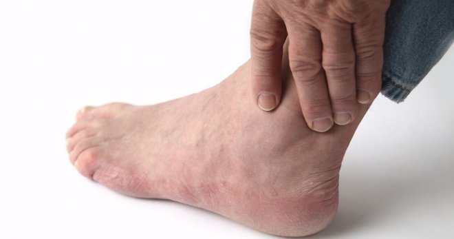 Opuch nohou - všechny možné příčiny a nejlepší léčba