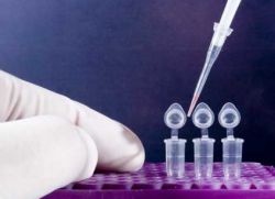detekci infekce pomocí PCR