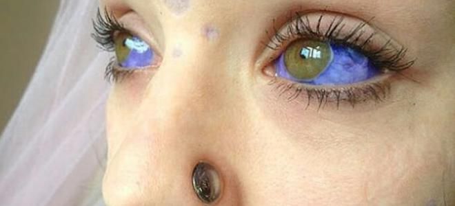 tetování na oční kouli