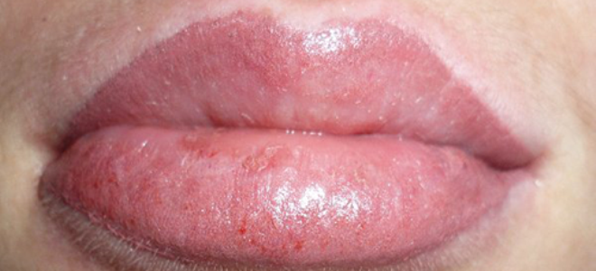 Едем след перманентен грим на устните